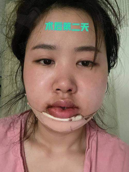 二、成都刘亚平医生擅长项目