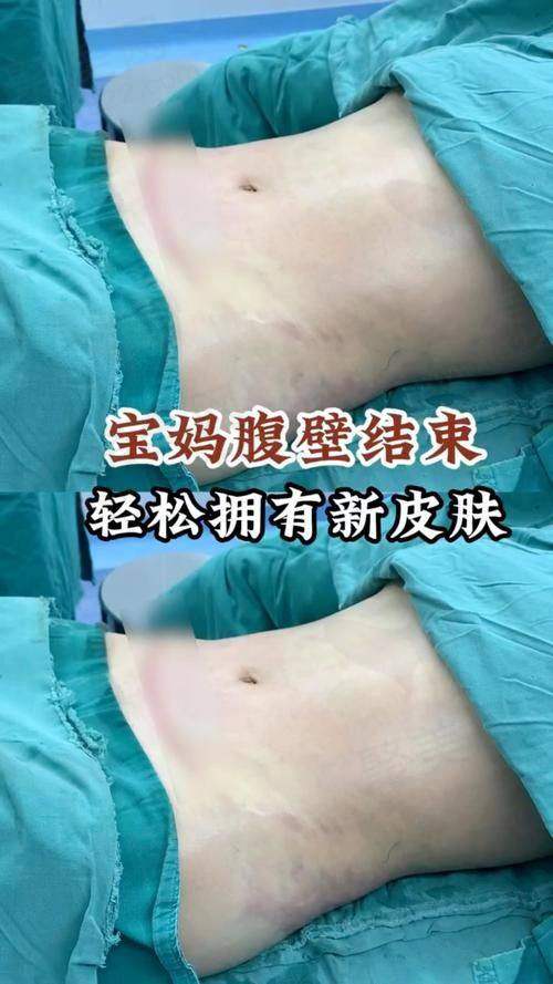 一、成都现代腹壁成形医院的基本情况