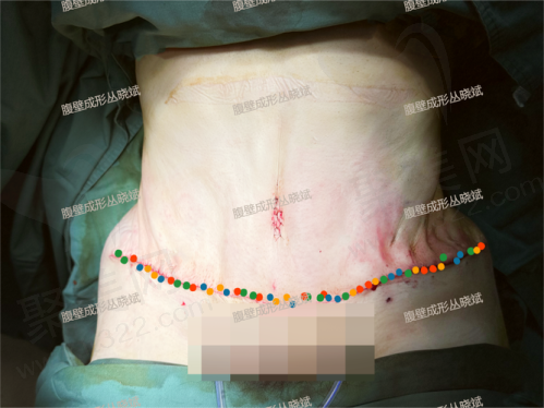 五、成都现代腹壁成形医院的其他优势