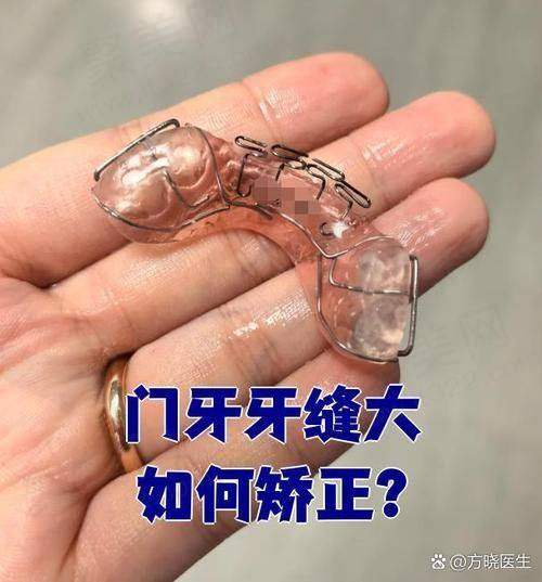林金强