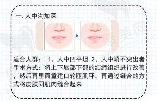 一、郑州人中缩短手术费用概况