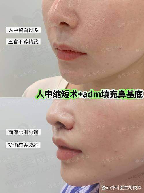 五、省钱攻略