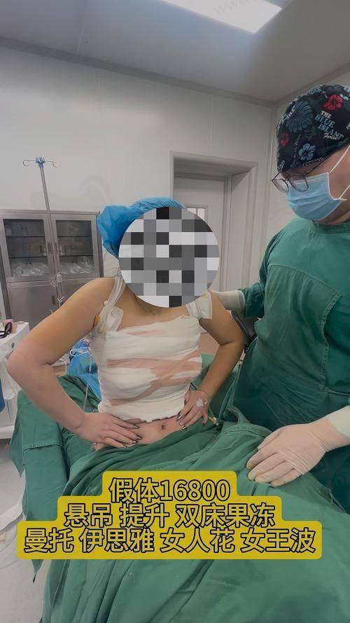 长沙祺美胸整形肖征刚曼托假体隆胸成效显著