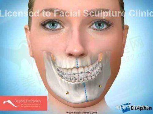 实力与口碑认可