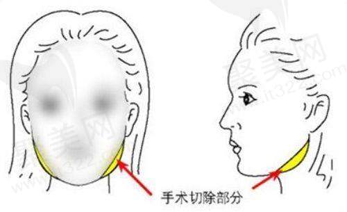 瑞格整形医院服务体验