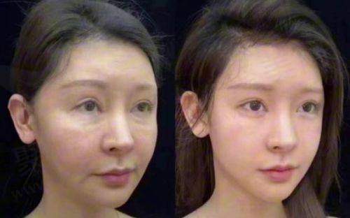 邢台市第一医院整形美容科