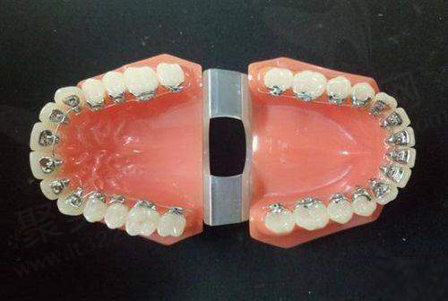 假牙<span style=