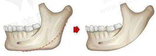 中山大学附属第一医院:具有影响力综合医院的可靠治疗