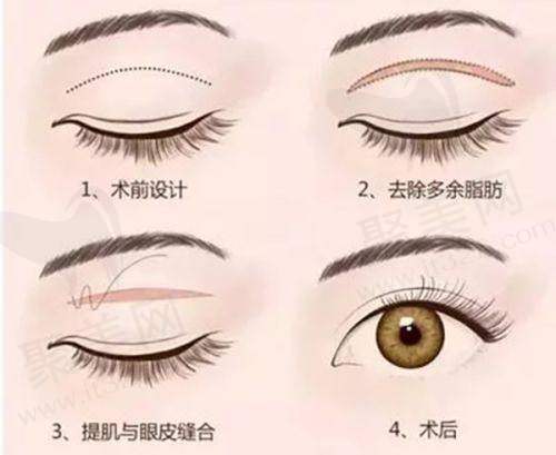 邢台遇见美医疗美容诊所