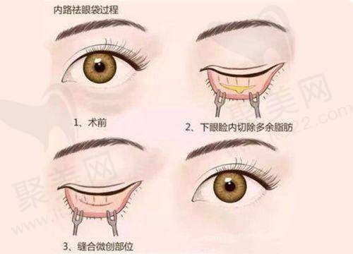 邢台市中 心医院整形美容科