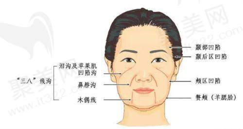 2025泰国有名私立医院变性手术价格参考