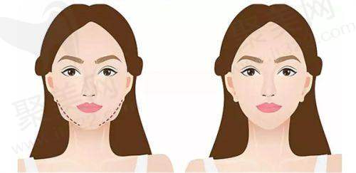 中大光华口腔医院:口腔专精优势助力治疗