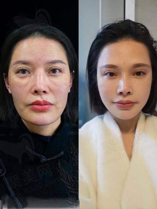 五、徐桂英收费价格表