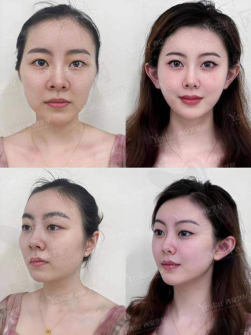 六、徐桂英怎么预约?