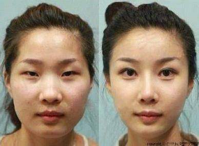 七、徐桂英真实的患者评价