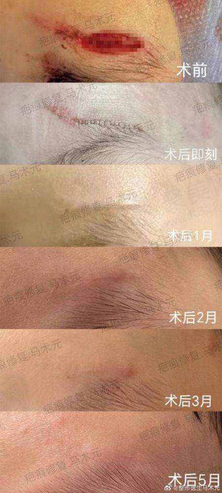 五、广州广大医院疤痕整形的优势总结