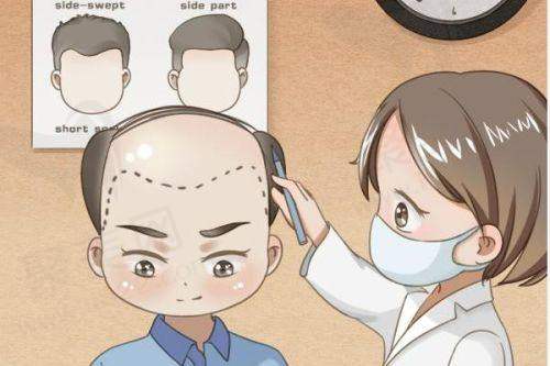 四、北京碧莲盛植发医生李嘉恒经典实例呈现