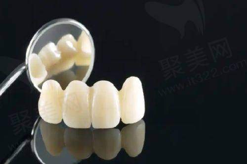 三、济南百年中牙口腔医院(山东种植总院)的特色项目