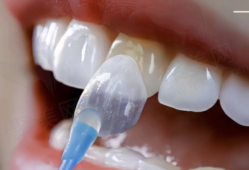 二、南宁柏乐口腔医院医疗服务质量：专科水准与人性化并存