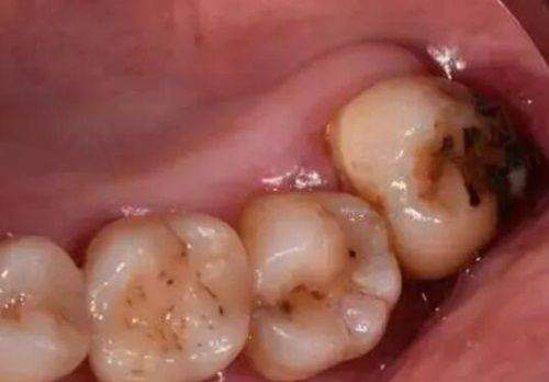 四、理性看待南宁柏乐口腔医院：不被网络不实言论误导