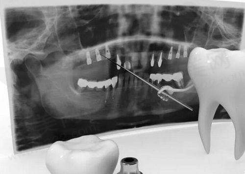 二、温州存济口腔医院医生技术怎么样