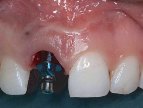 5、绵阳中绵口腔宋起医生患者评价