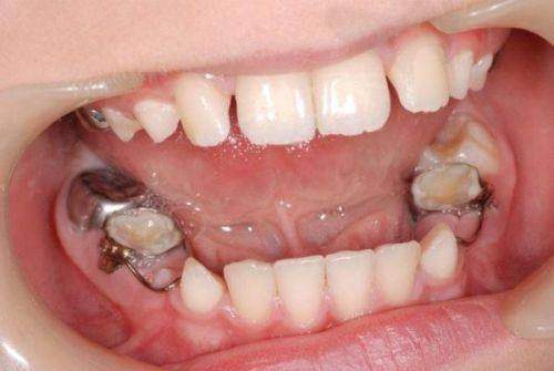 四、乐清齿逸口腔口碑之收费标准