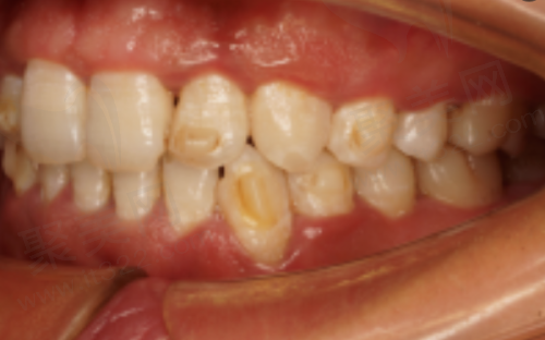 三、乐清齿逸口腔口碑之服务体验