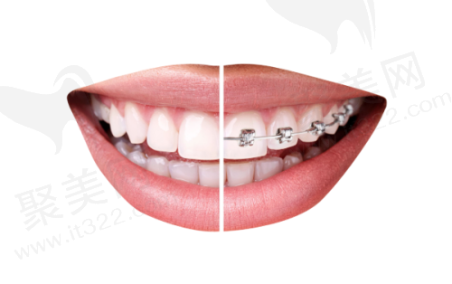 六、乐清齿逸口腔口碑之横向对比定位