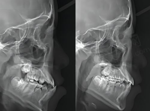六、如何选择是否适合自己