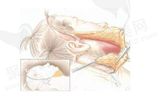 成都三大植发医院价格对比总结