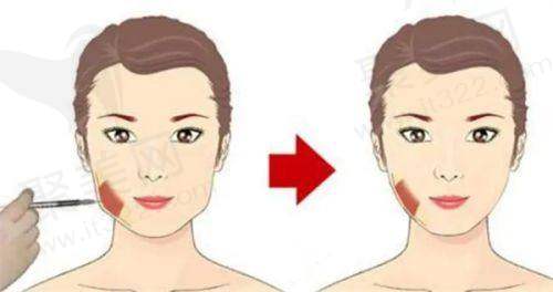 四、高峰医生的成功实例