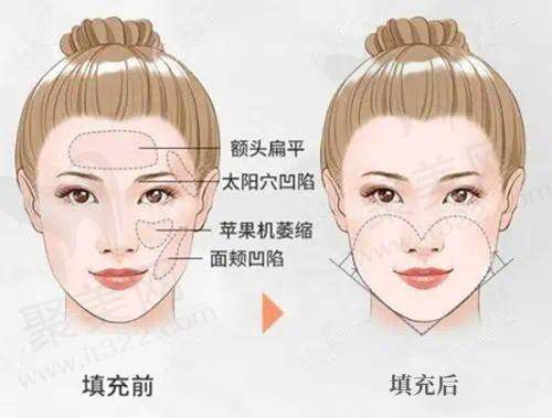 三、高峰医生擅长技术及优势