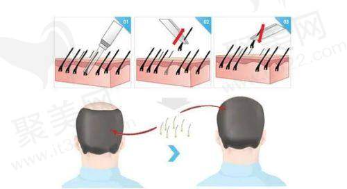 技术精良可靠,满足多样需求