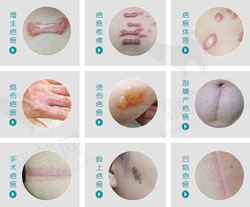 手术成效层面:显著成效见证技术实力