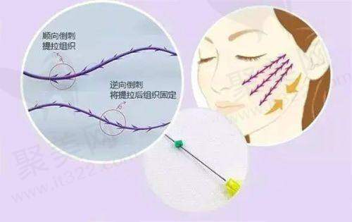 价格层面:合理收费凸显性价比