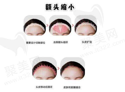 五、求美者对高峰医生的评价