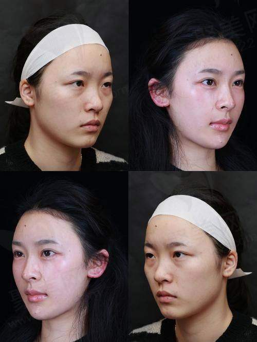 七、闫伦医生真实的患者评价