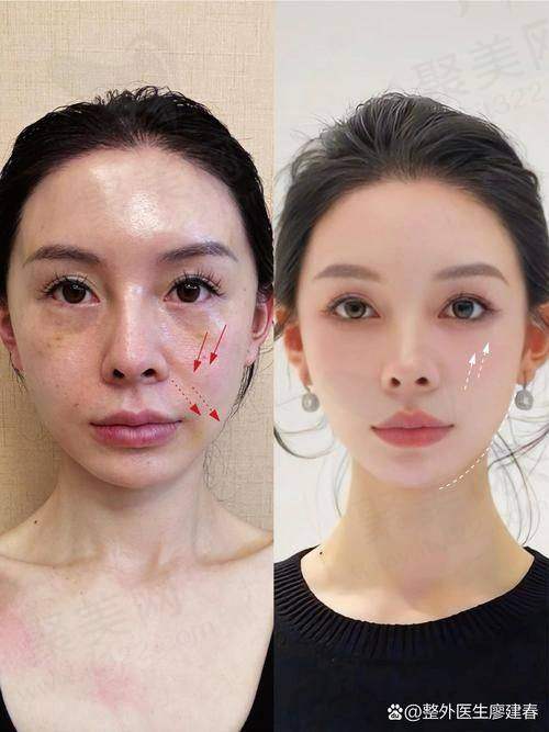 五、北京清采医生简介图片高清的意义