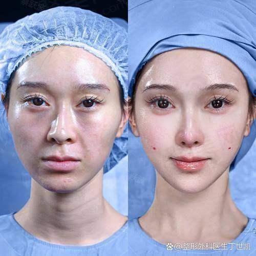 三、闫伦医生技术怎么样?