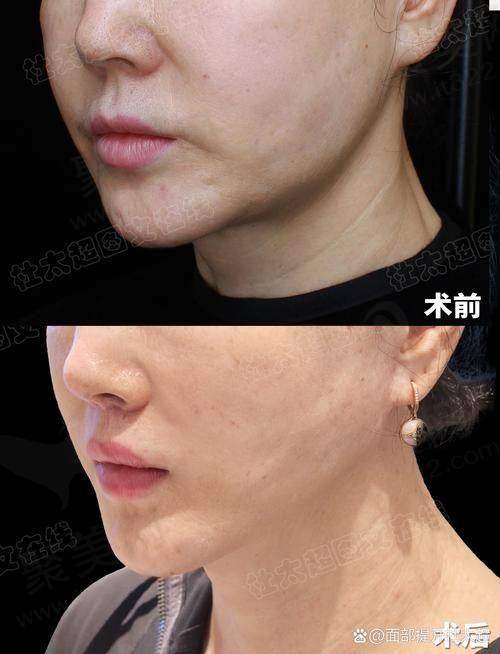 四、上海艺星郭敬松医生口碑评价