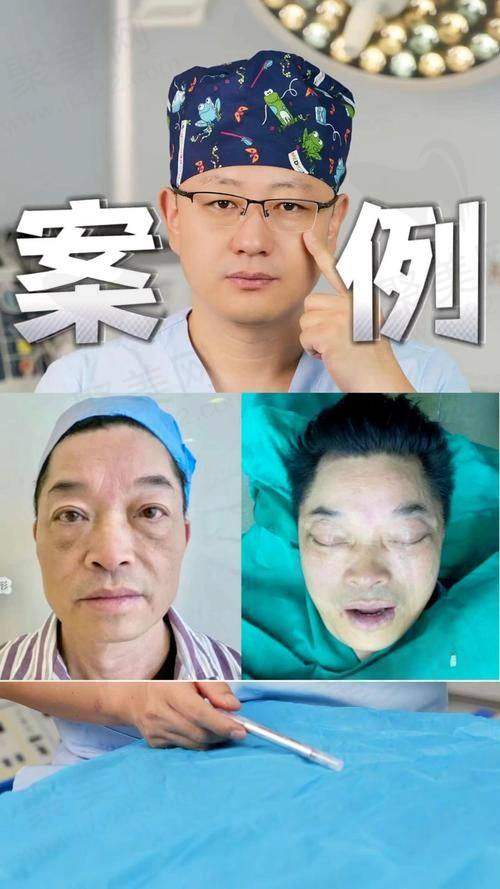 四、杜太超医生拉皮手术的优势