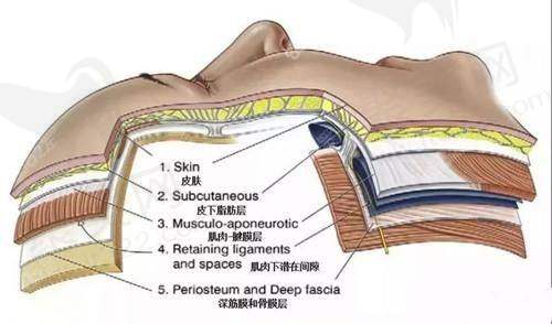 三、杜太超医生的拉皮手术特色