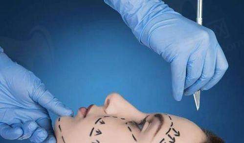 二、拉皮手术的常见认知与疑问