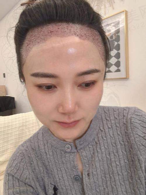 六、北京碧莲盛植发医生李嘉恒收费情况分析