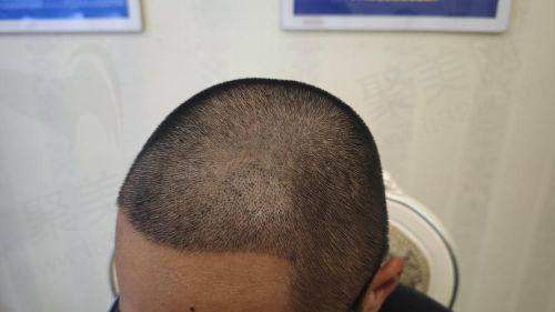 医院资质正规,奠定靠谱基础