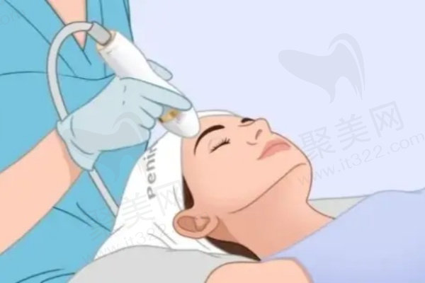 广州荔医医疗美容激光淡化胎记原价2000元，现680元起开启无瑕肌肤之旅