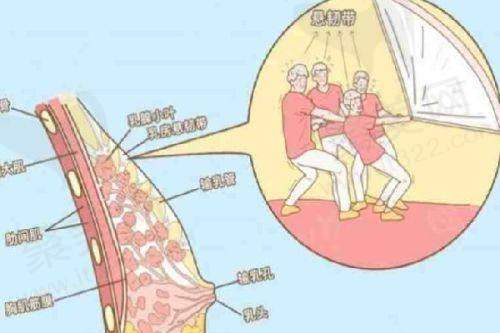 二、齐云香医生缩胸手术技术亮点