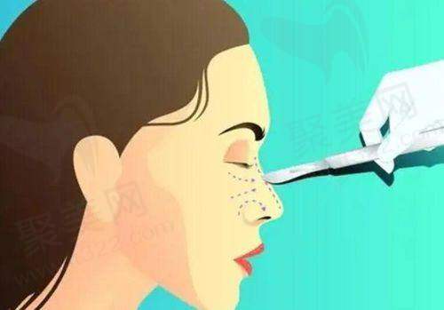 二、南宁华美卢志刚医生擅长技术