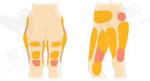 南宁大麦微针植发——微创技术的领跑者